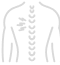 Cauda equina syndrome