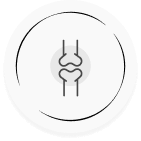Radiculopathy