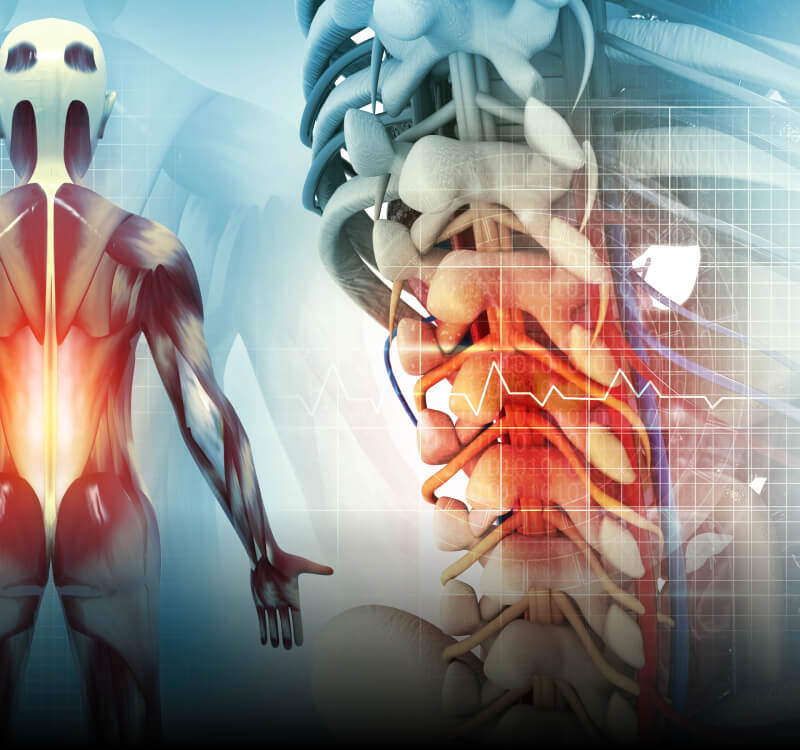 Neurogenic Claudication