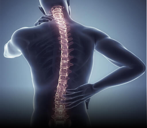Neurogenic Claudication
