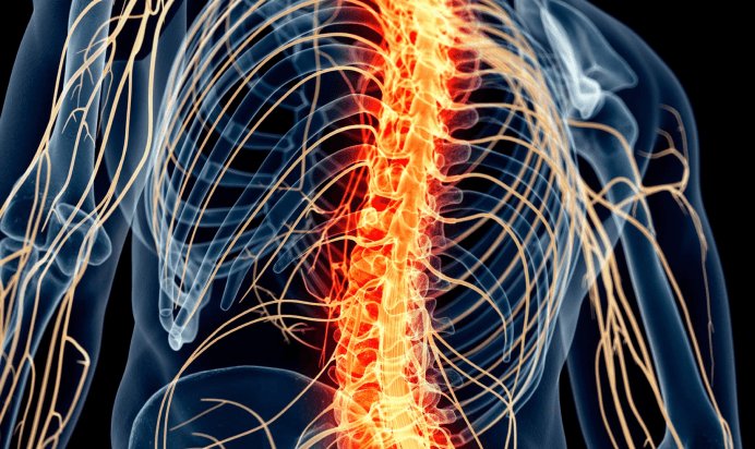 Cause of Spinal Stenosis