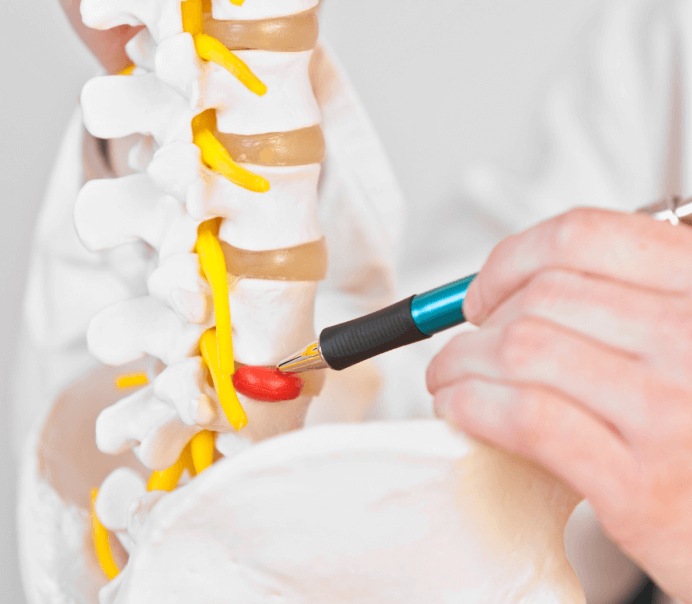 Causes of Spinal Stenosis