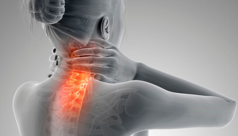 Cervical Pain