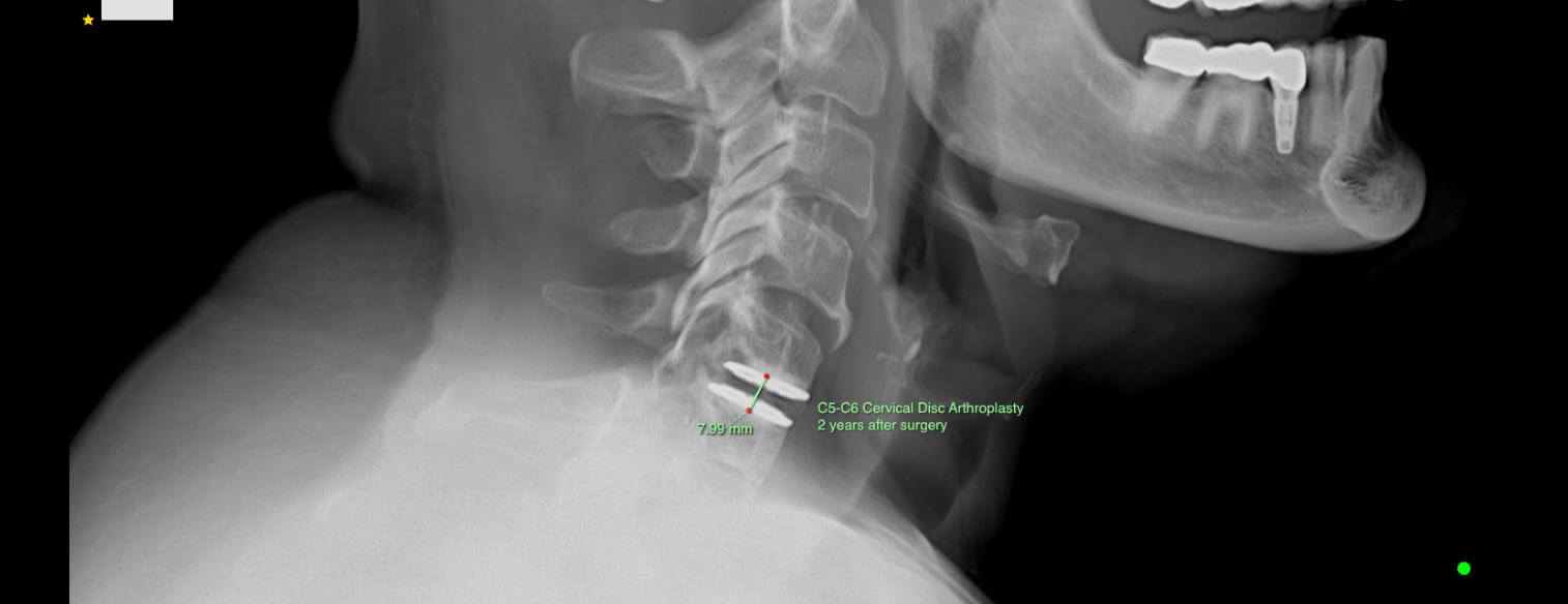 img-patient-1-after