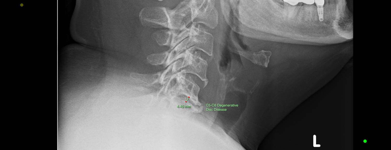 img-patient-1-before