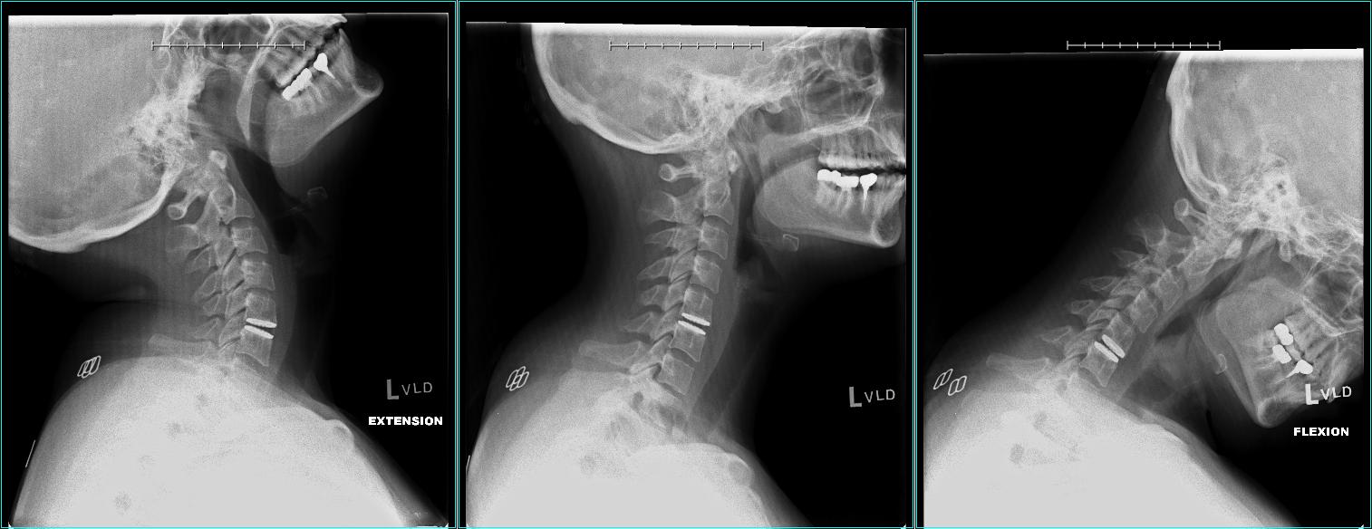 img-patient-2-after