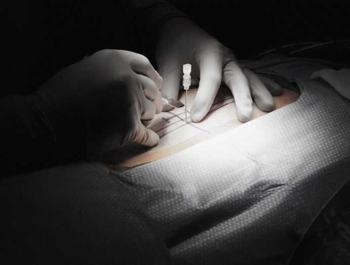 Innovative Surgeries