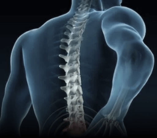 Lumbar Stenosis