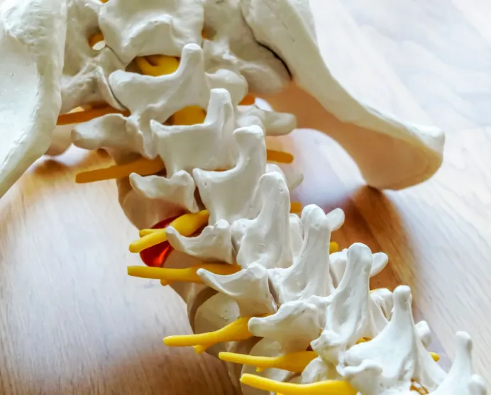 Causes of Neurogenic Claudication