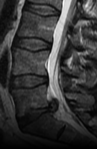 spinal radiological assessment 2nd-sm-dimension