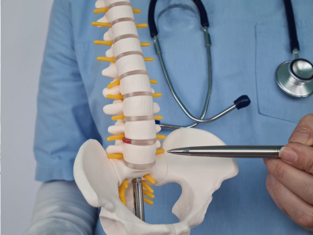 Lumbar Spinal Fusion