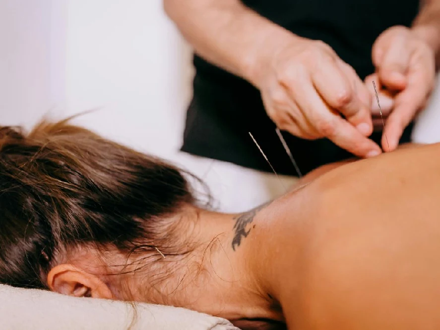 acupuncture for sciatica pain quick relief