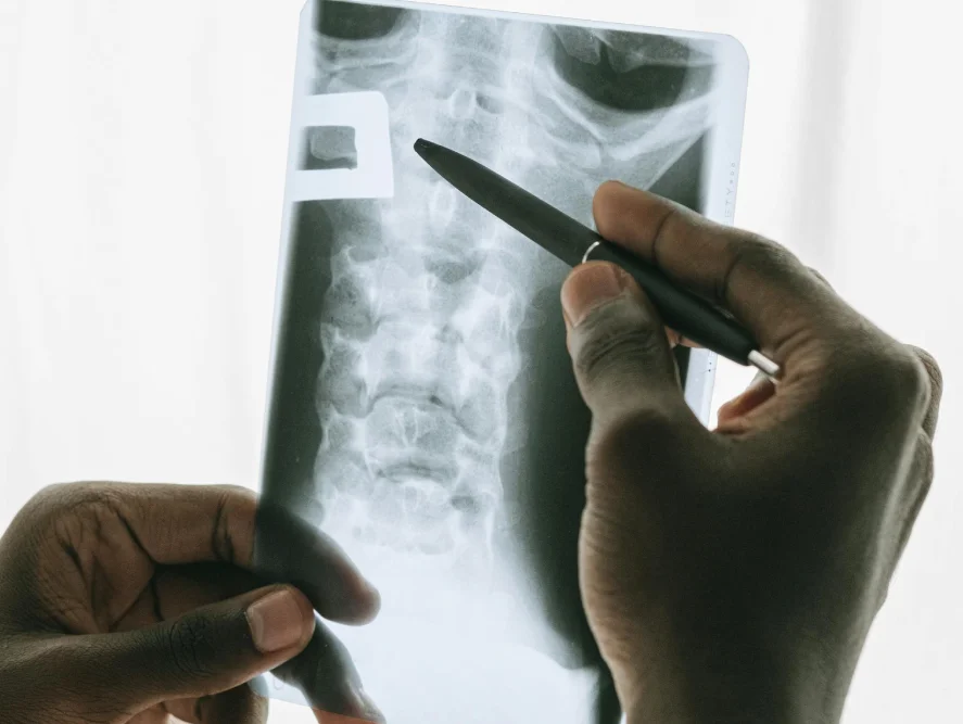 Spine Curvature Disorder Treatment Options